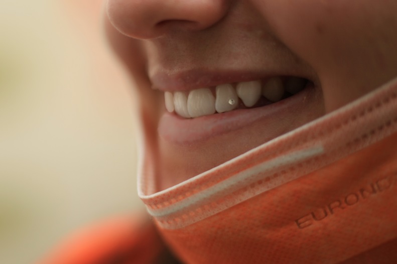 Esztétikai kezelések ThermalDent Sárvár